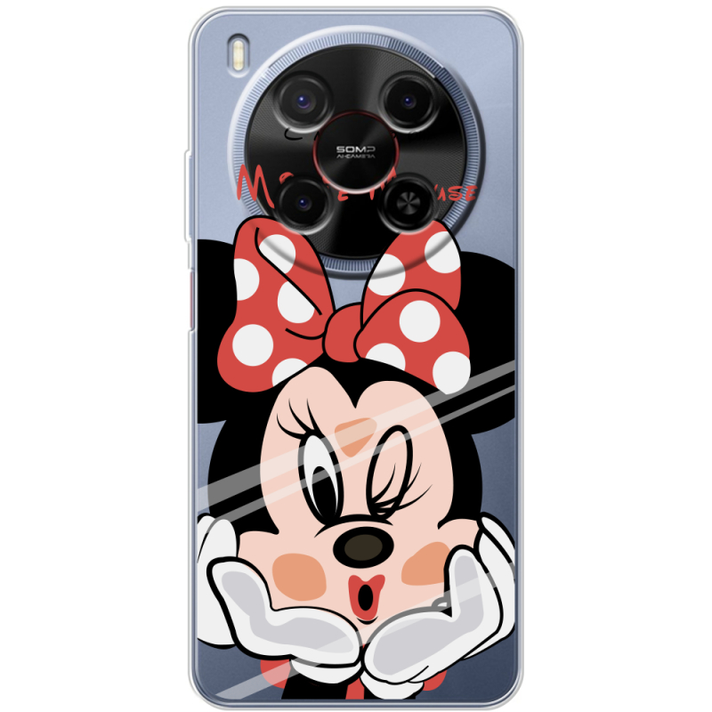 Прозорий чохол BoxFace Nubia V70 Max Lady M