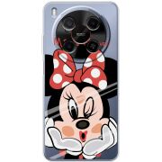 Прозорий чохол BoxFace Nubia V70 Max Lady M