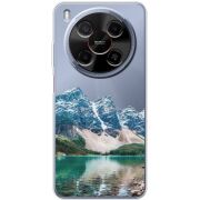 Прозорий чохол BoxFace Nubia V70 Max Blue Mountain