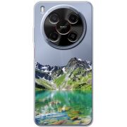 Прозорий чохол BoxFace Nubia V70 Max Green Mountain