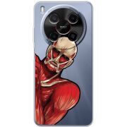 Прозорий чохол BoxFace Nubia V70 Max Титан