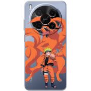 Прозорий чохол BoxFace Nubia V70 Max Naruto and Kurama