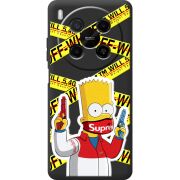 Чорний чохол BoxFace Nubia V70 Max White Bart