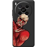 Чорний чохол BoxFace Nubia V70 Max Титан