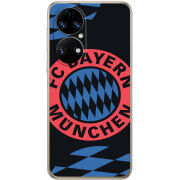 Чохол BoxFace Huawei P50 FC Bayern