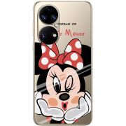 Прозорий чохол BoxFace Huawei P50 Lady M