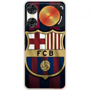 Чохол BoxFace Nubia Music 2 