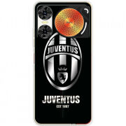 Чохол BoxFace Nubia Music 2 