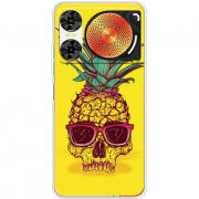 Чохол BoxFace Nubia Music 2 Pineapple Skull