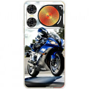 Чохол BoxFace Nubia Music 2 