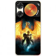 Чохол BoxFace Nubia Music 2 