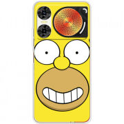 Чохол BoxFace Nubia Music 2 