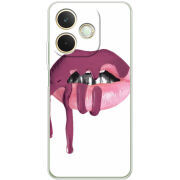 Чохол BoxFace OPPO A5 Pro 