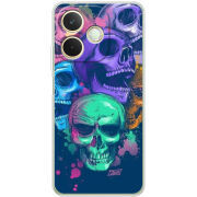 Чохол BoxFace OPPO A5 Pro 