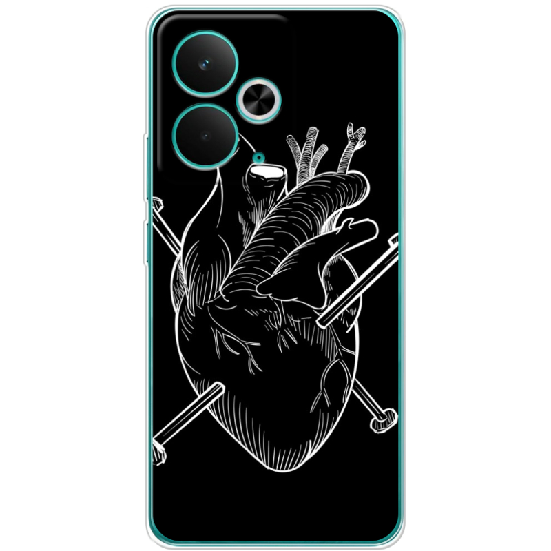 Чохол BoxFace Realme 14T 