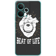 Чохол BoxFace Realme 14T 