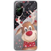 Прозорий чохол BoxFace Poco F7 Winter Deer