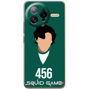 Чохол BoxFace Poco F7 Ultra siquid game 456