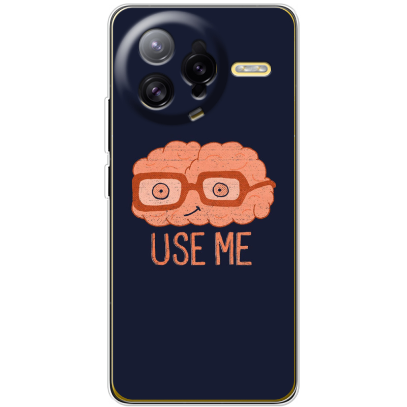 Чохол BoxFace Poco F7 Ultra 