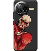 Чорний чохол BoxFace Poco F7 Ultra Титан