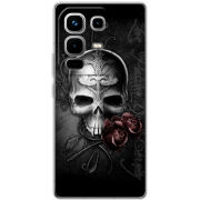 Чохол BoxFace Infinix Note 50 