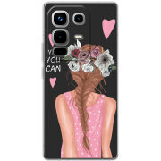 Чохол BoxFace Infinix Note 50 You Can