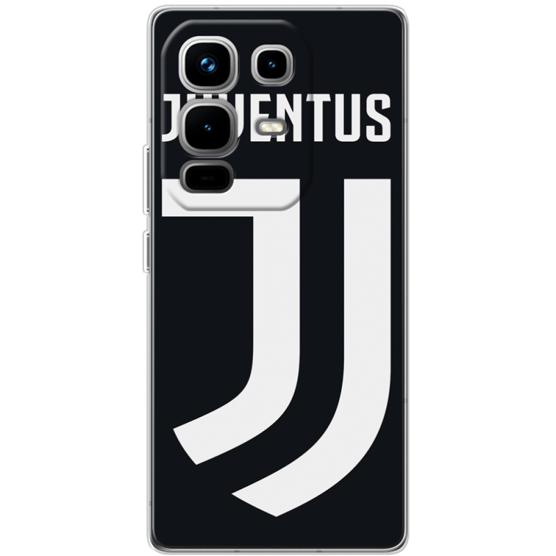 Чохол BoxFace Infinix Note 50 FC J