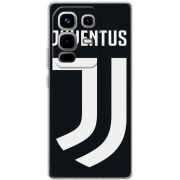 Чохол BoxFace Infinix Note 50 FC J