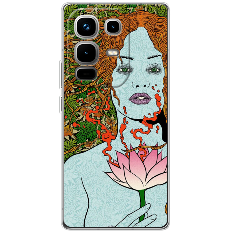 Чохол BoxFace Infinix Note 50 