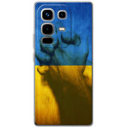 Чохол BoxFace Infinix Note 50 Handshake