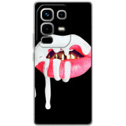 Чохол BoxFace Infinix Note 50 