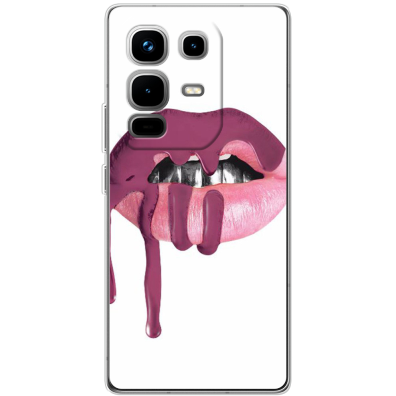 Чохол BoxFace Infinix Note 50 