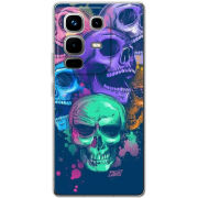 Чохол BoxFace Infinix Note 50 