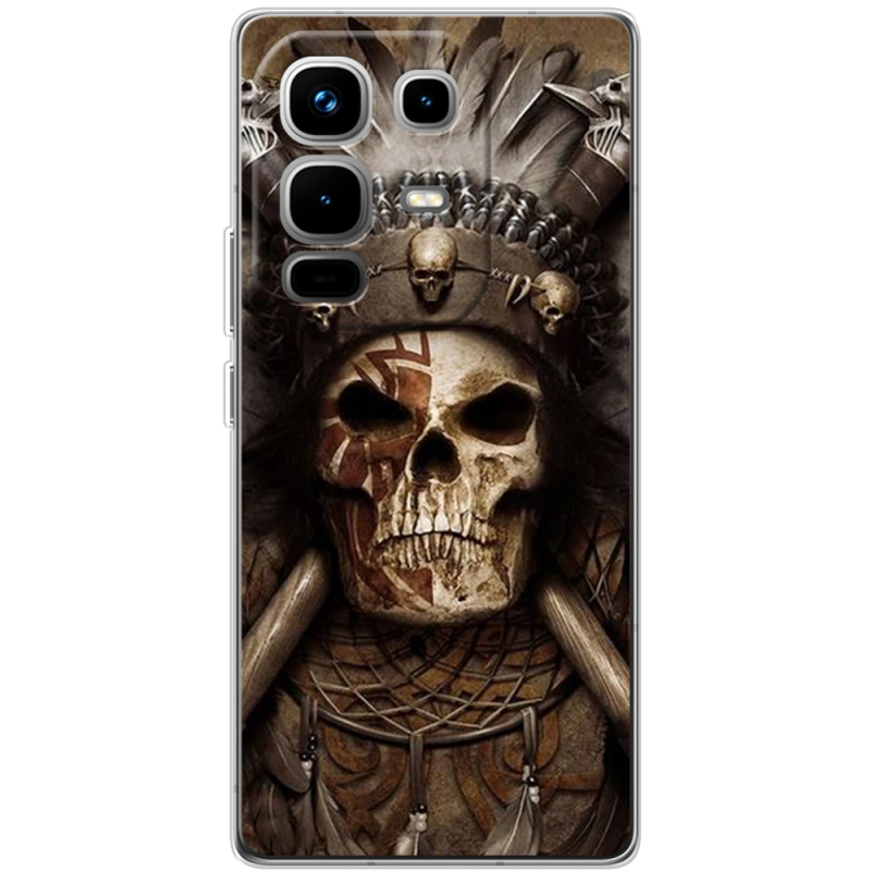 Чохол BoxFace Infinix Note 50 