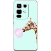 Чохол BoxFace Infinix Note 50 