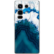 Чохол BoxFace Infinix Note 50 