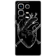 Чохол BoxFace Infinix Note 50 