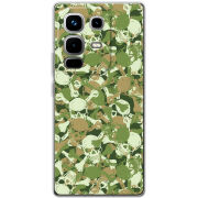 Чохол BoxFace Infinix Note 50 