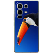 Чохол BoxFace Infinix Note 50 