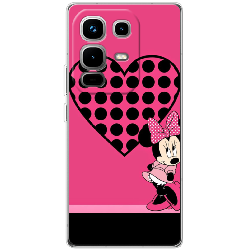 Чохол BoxFace Infinix Note 50 Pro 