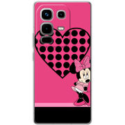 Чохол BoxFace Infinix Note 50 Pro 