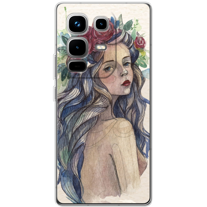 Чохол BoxFace Infinix Note 50 Pro 