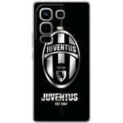 Чохол BoxFace Infinix Note 50 Pro 