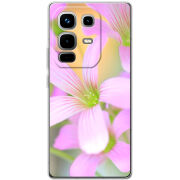 Чохол BoxFace Infinix Note 50 Pro 