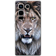 Чохол BoxFace Infinix Note 50 Pro 