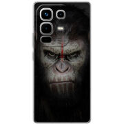 Чохол BoxFace Infinix Note 50 Pro 