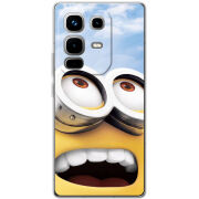 Чохол BoxFace Infinix Note 50 Pro 