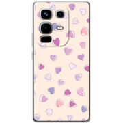 Чохол BoxFace Infinix Note 50 Pro 