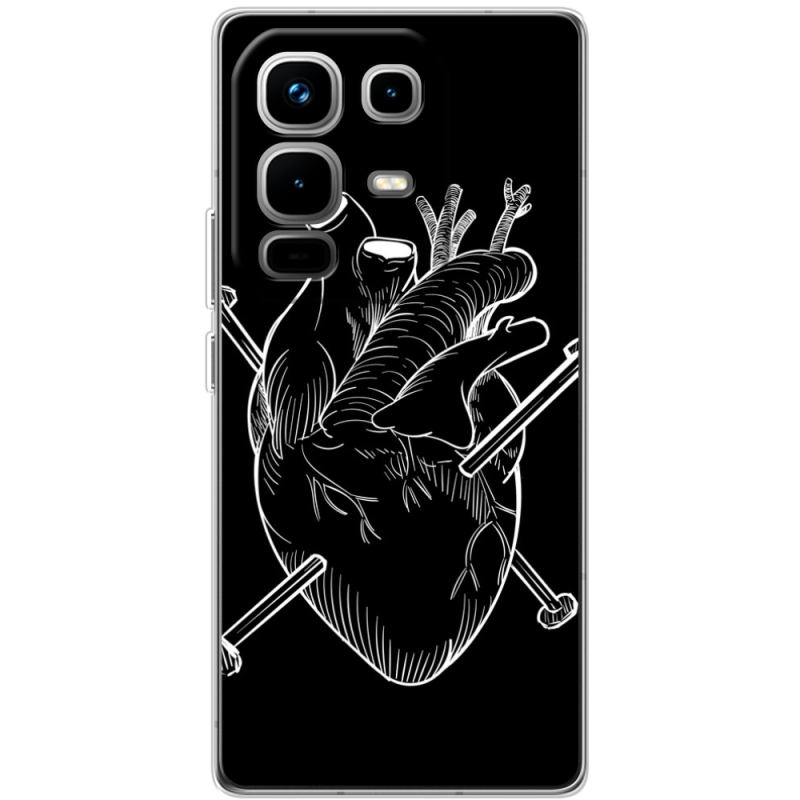 Чохол BoxFace Infinix Note 50 Pro 