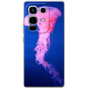 Чохол BoxFace Infinix Note 50 Pro 